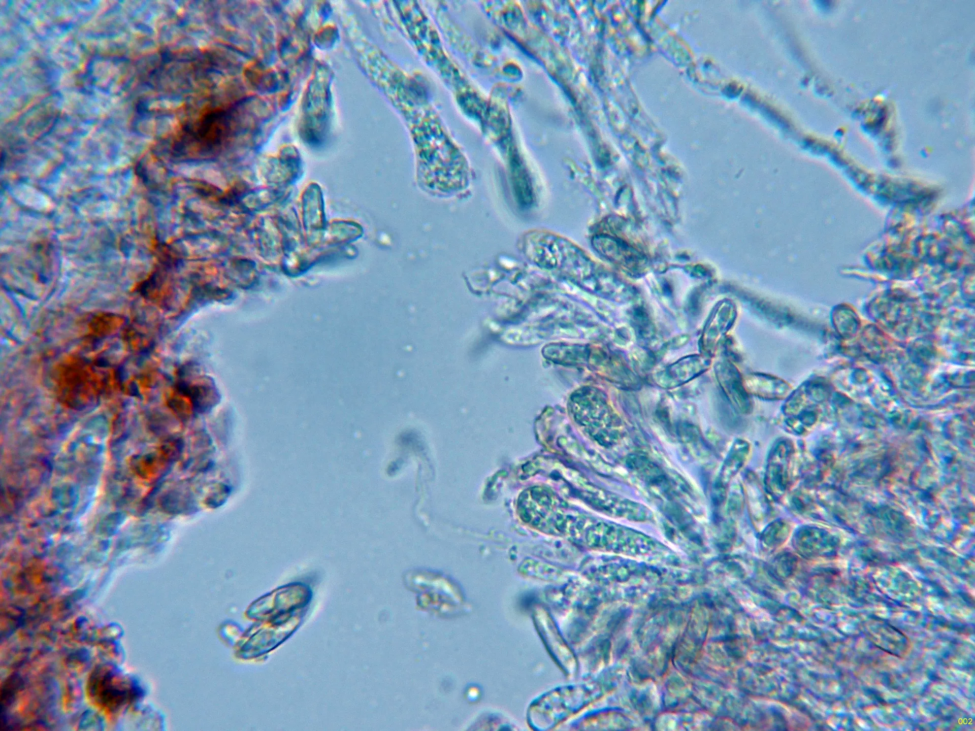 Microscopía de Ramaria lutea - 10 - Basidios-002